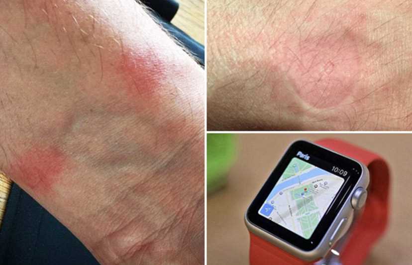 How to Properly Wear a Smart Watch to Minimize Discomfort