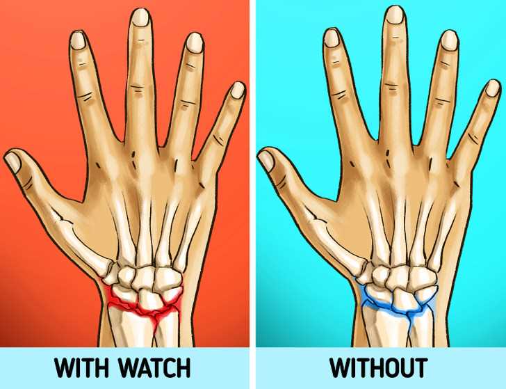 Identifying Signs of Discomfort from Watch Wear