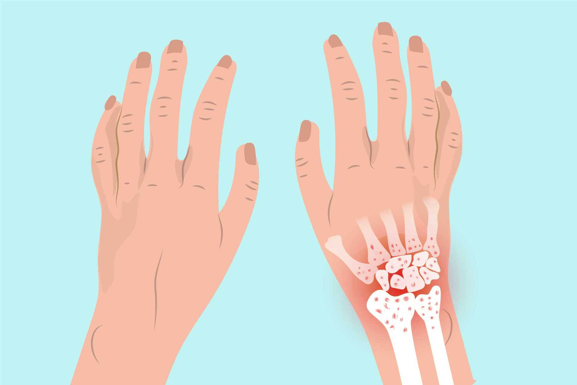 Impact of Timepieces on Joint Health